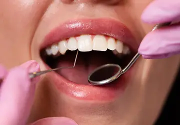 LaniDental_Opca_Stomatologija_usluge